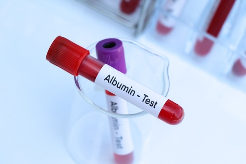 Tout savoir sur les albumines