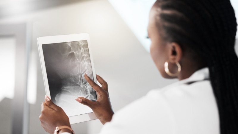 Tout savoir sur le pincement discal