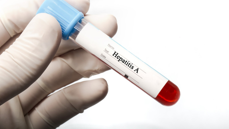 Tout savoir sur l'hépatite A