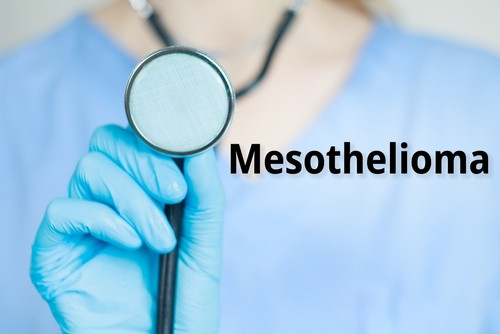 Mésothéliome : un cancer silencieux à surveiller de près