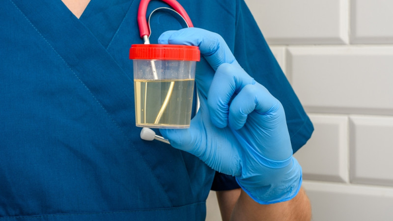 échantillon d'urine transparente