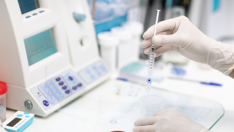 analyse d'échantillon en laboratoire