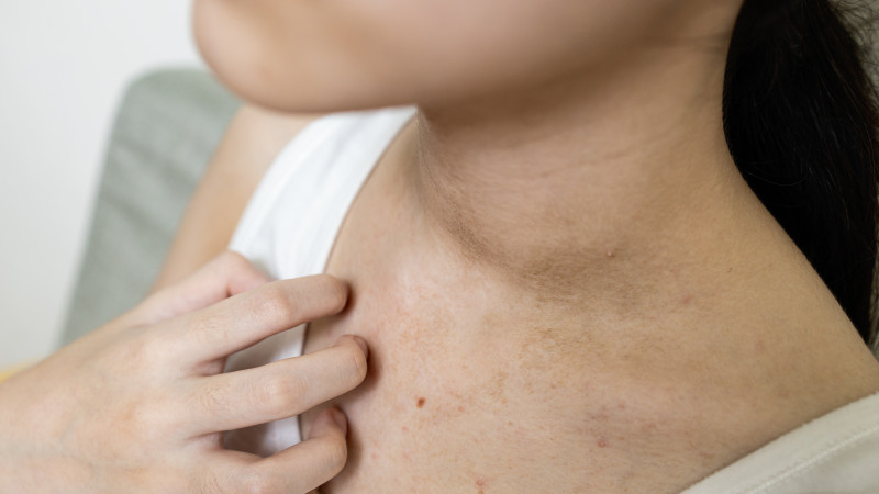 femme qui gratte sa peau