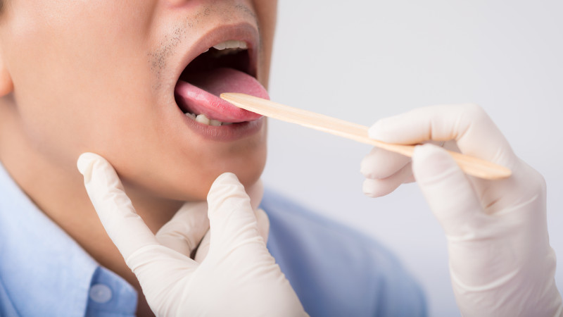 docteur regarde dans la bouche d'un homme