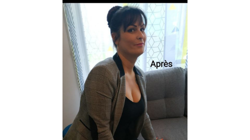 Photo avant régime