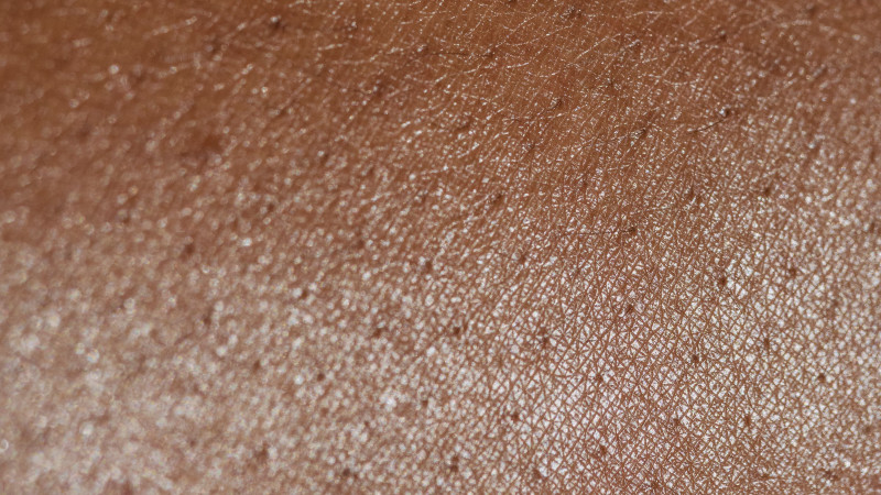 Image macro détaillée capturant la texture et les détails de la surface de la peau humaine avec un éclairage naturel.